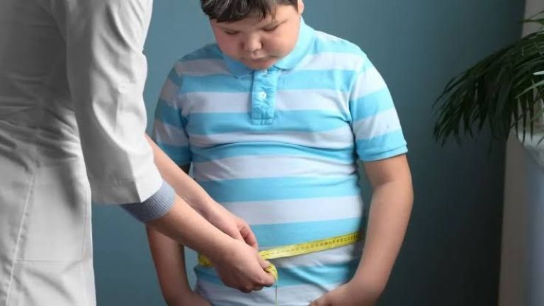 Obesitas Anak Bukan Sekadar Masalah Berat Badan