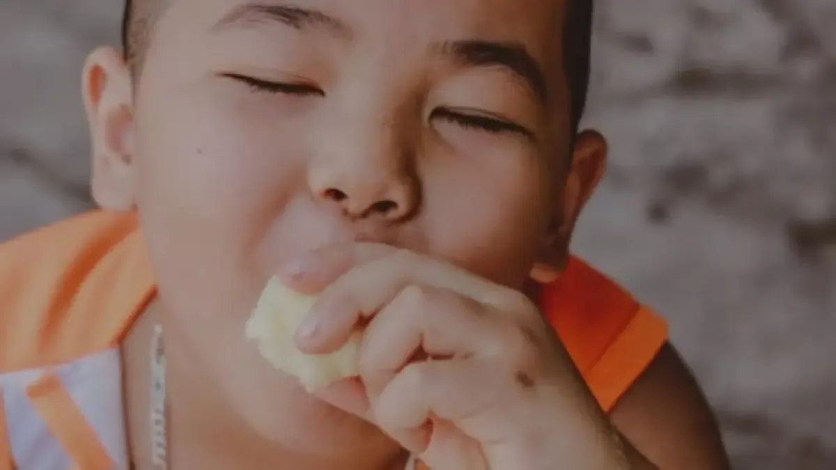 Obesitas Anak Bukan Sekadar Masalah Berat Badan