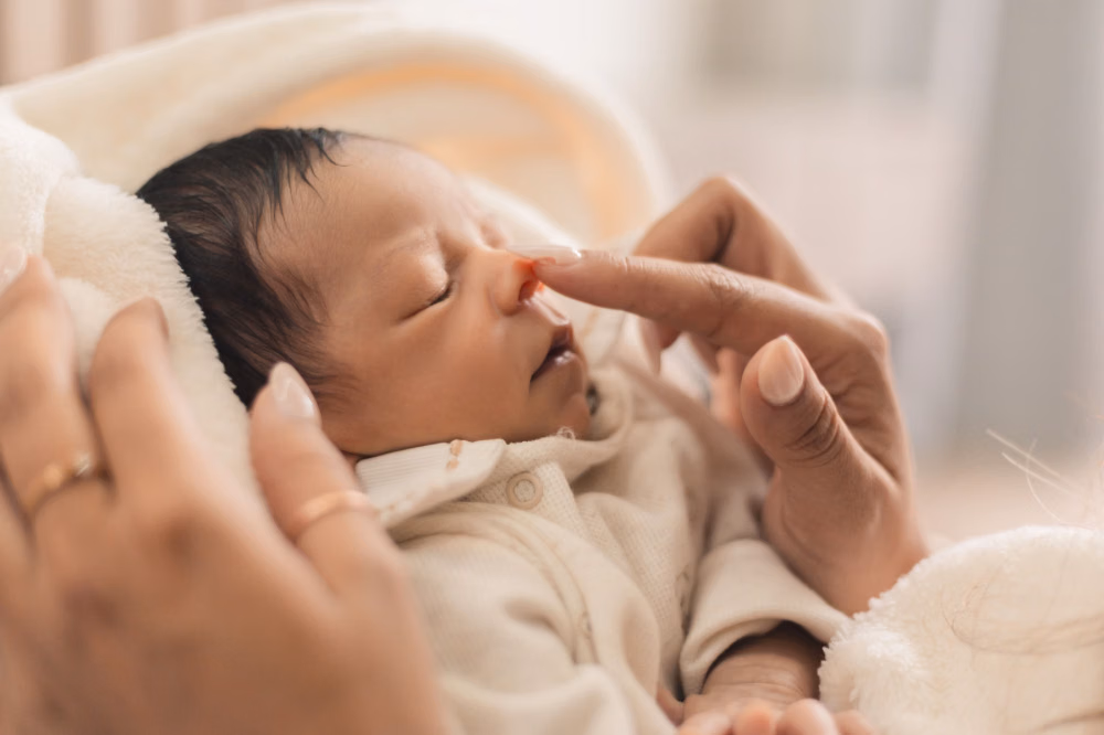 Bintik Putih pada Bayi Baru Lahir: Kapan Hilang dan Cara Merawatnya