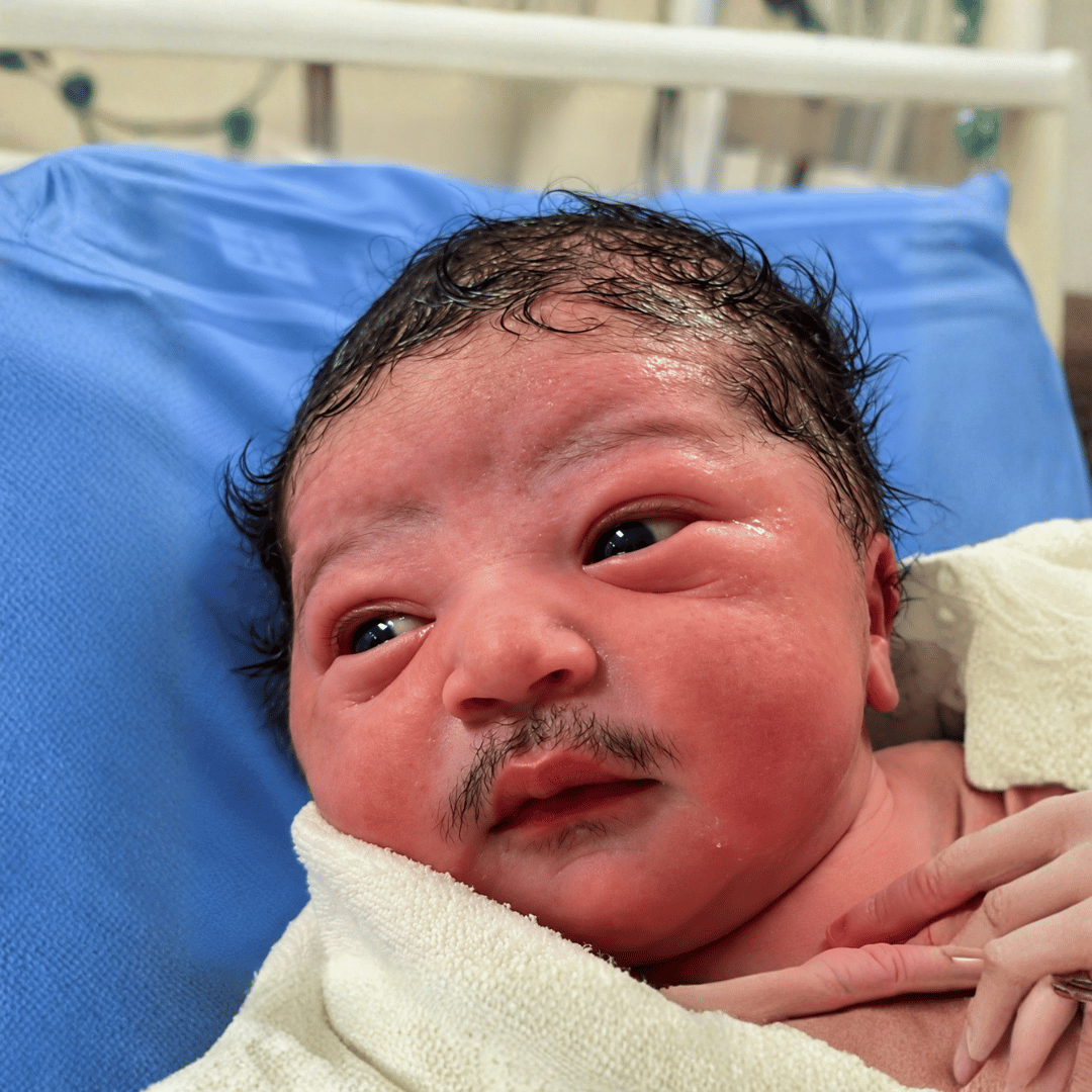 Bayi Baru Lahir Berambut Lebat? Kenali Lanugo dan Fungsinya