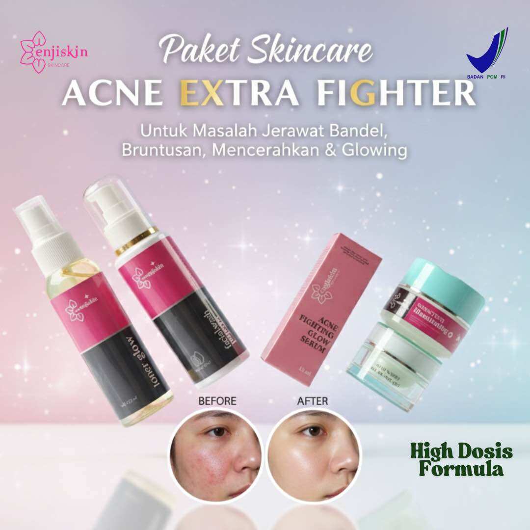 Turun 25%: Skincare wajah Paket komplit