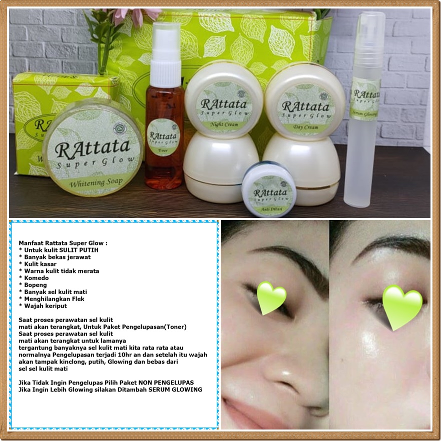 Turun 28%: RAttata Super Glow