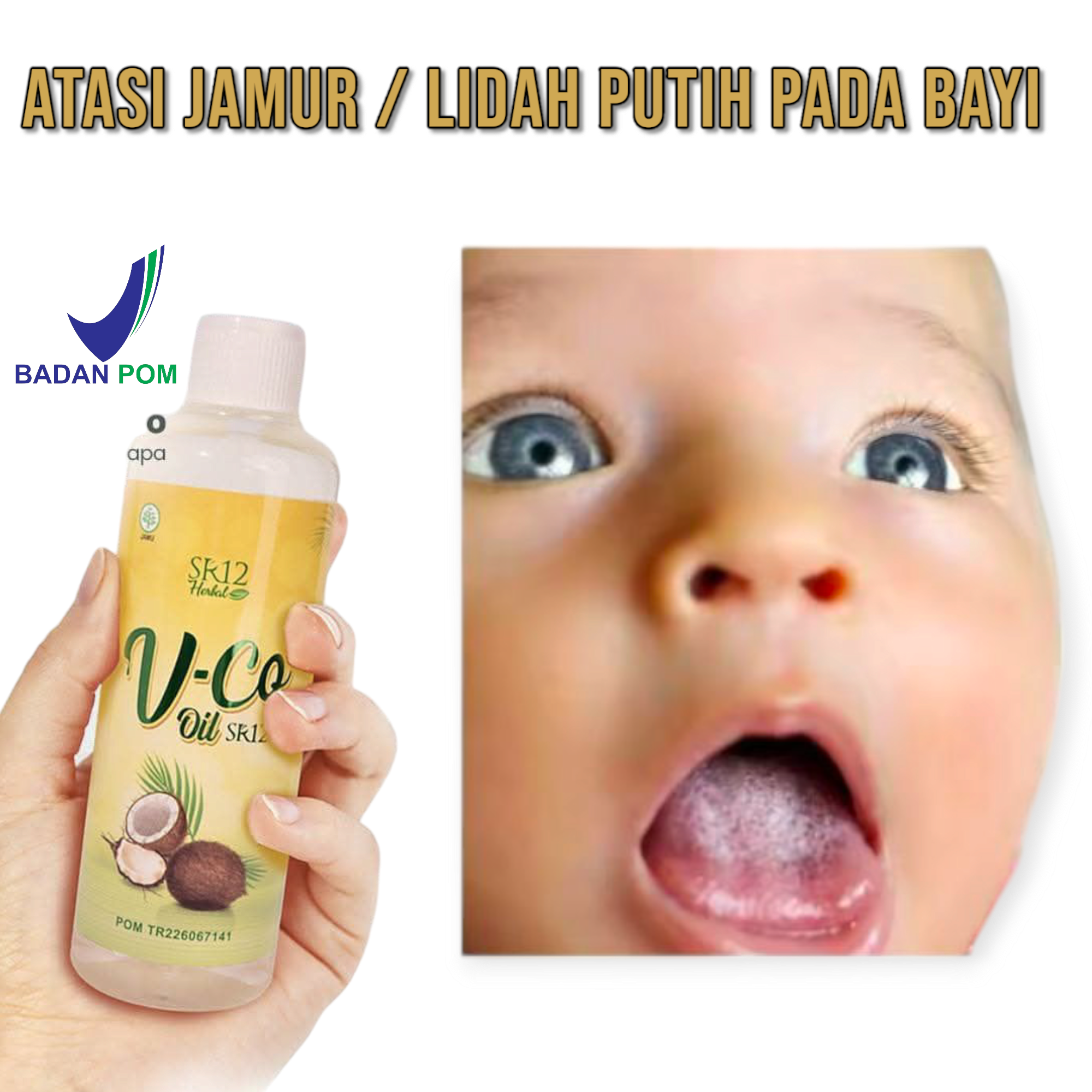 Turun 34%: VCO SR12 obat lidah putih