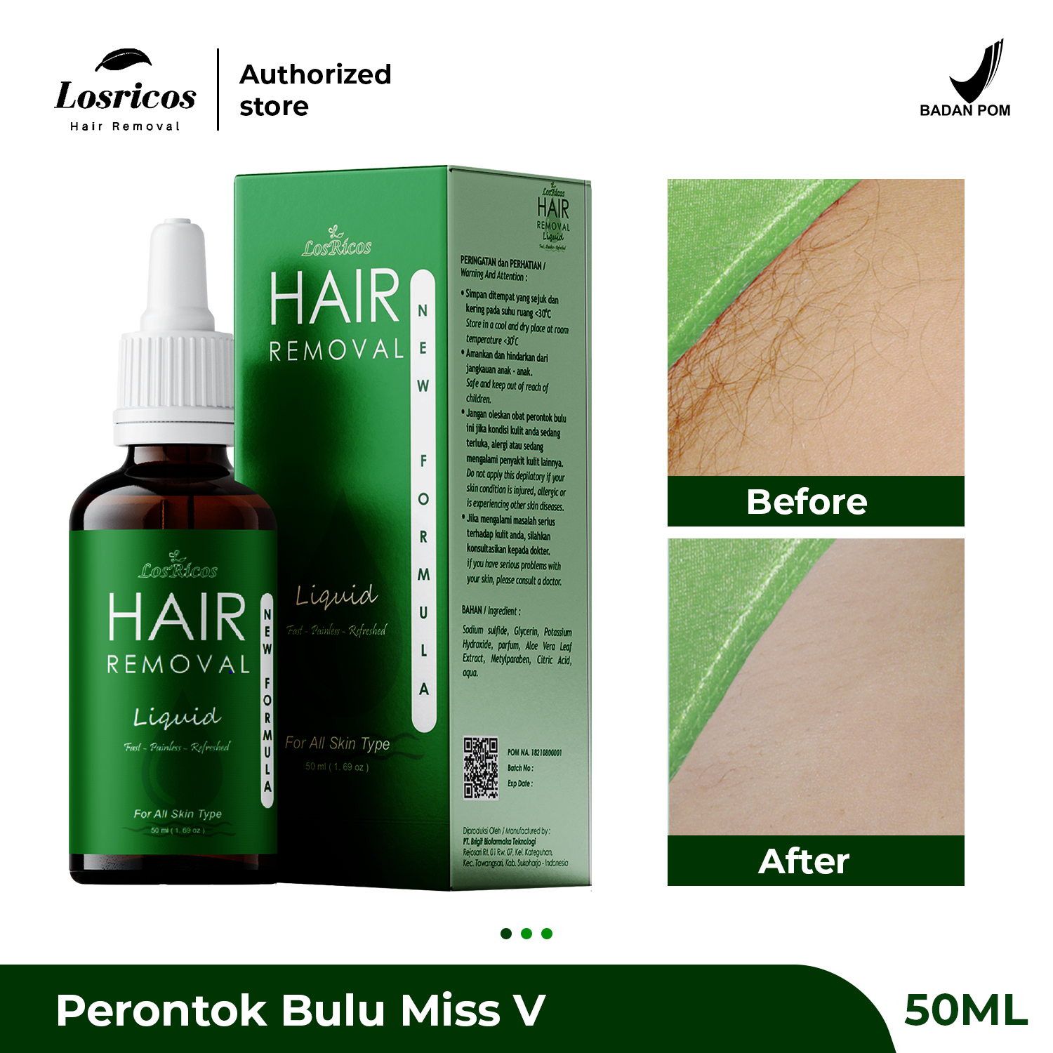 Turun 21%: Losricos Hair Removal