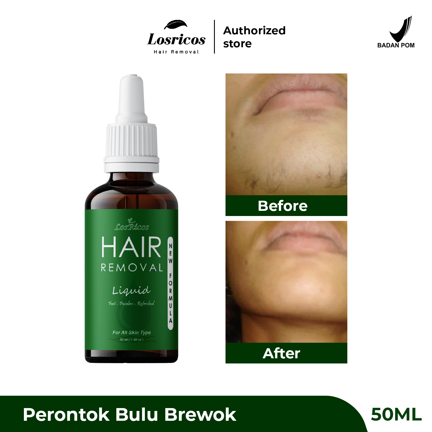 Turun 22%: Losricos Hair Removal Liquid