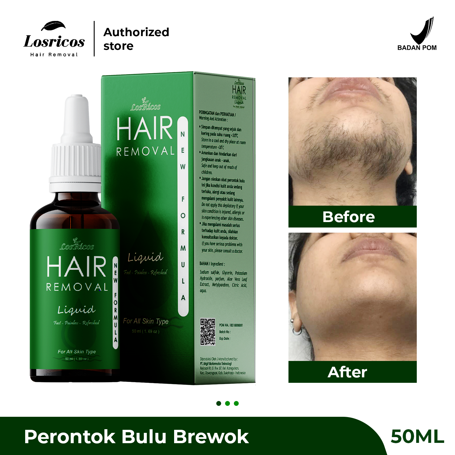 Turun 24%: Perontok Bulu Brewok Permanen