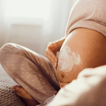 Panduan Memilih Stretch Mark Cream yang Aman untuk Ibu Hamil
