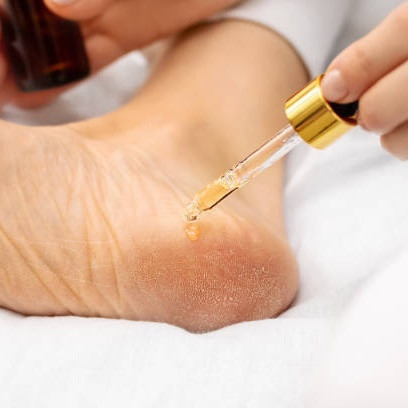 Manfaat Minyak Zaitun untuk Tumit Pecah-Pecah