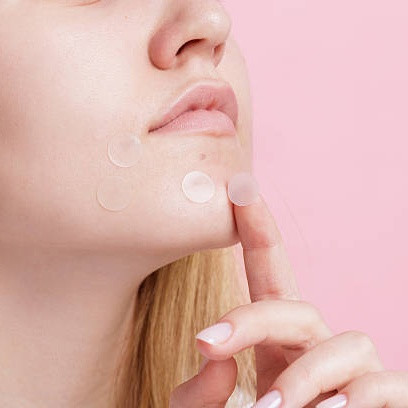 Panduan Lengkap Memilih dan Menggunakan Acne Patch