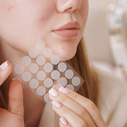 Mengenal Acne Patch dan Cara Kerjanya Pada Jerawat
