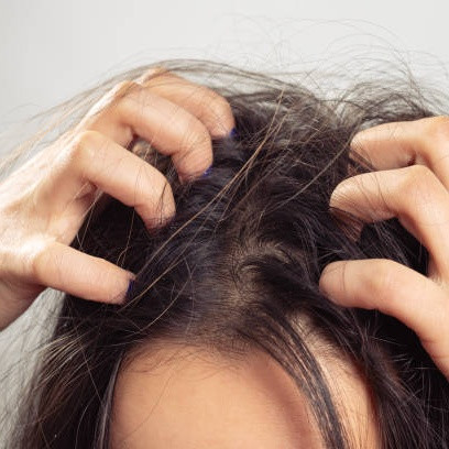 Hair Tonic Bikin Rambut Gatal? Ini Cara Pakai yang Lebih Aman