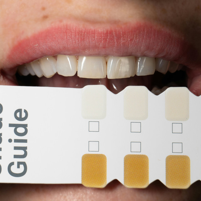 Kenapa Gigi Tetap Kuning Padahal Rajin Sikat Gigi? Ini Jawabannya