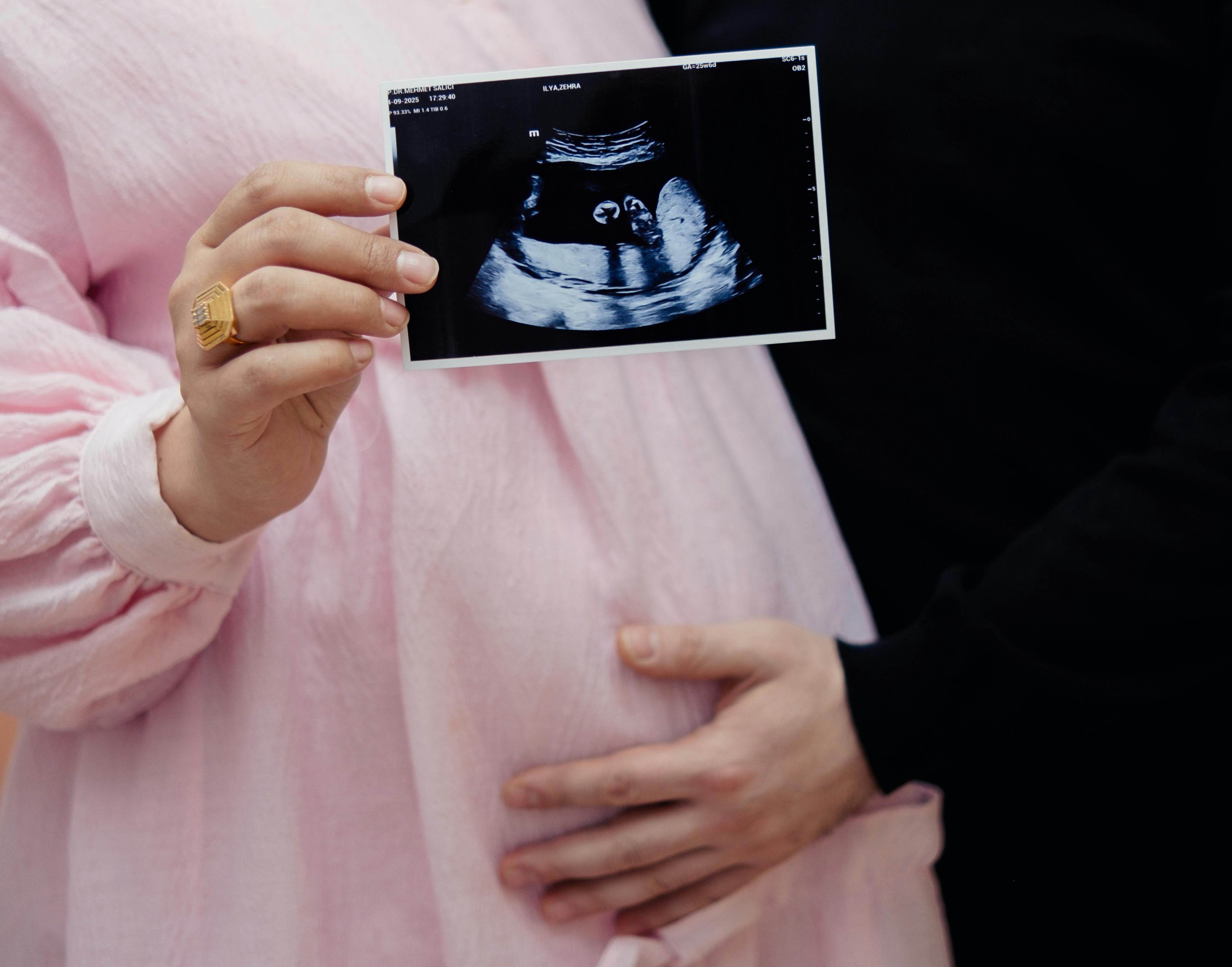 Cara Deteksi Dini Preeklampsia Menggunakan Fetal Doppler Portabel
