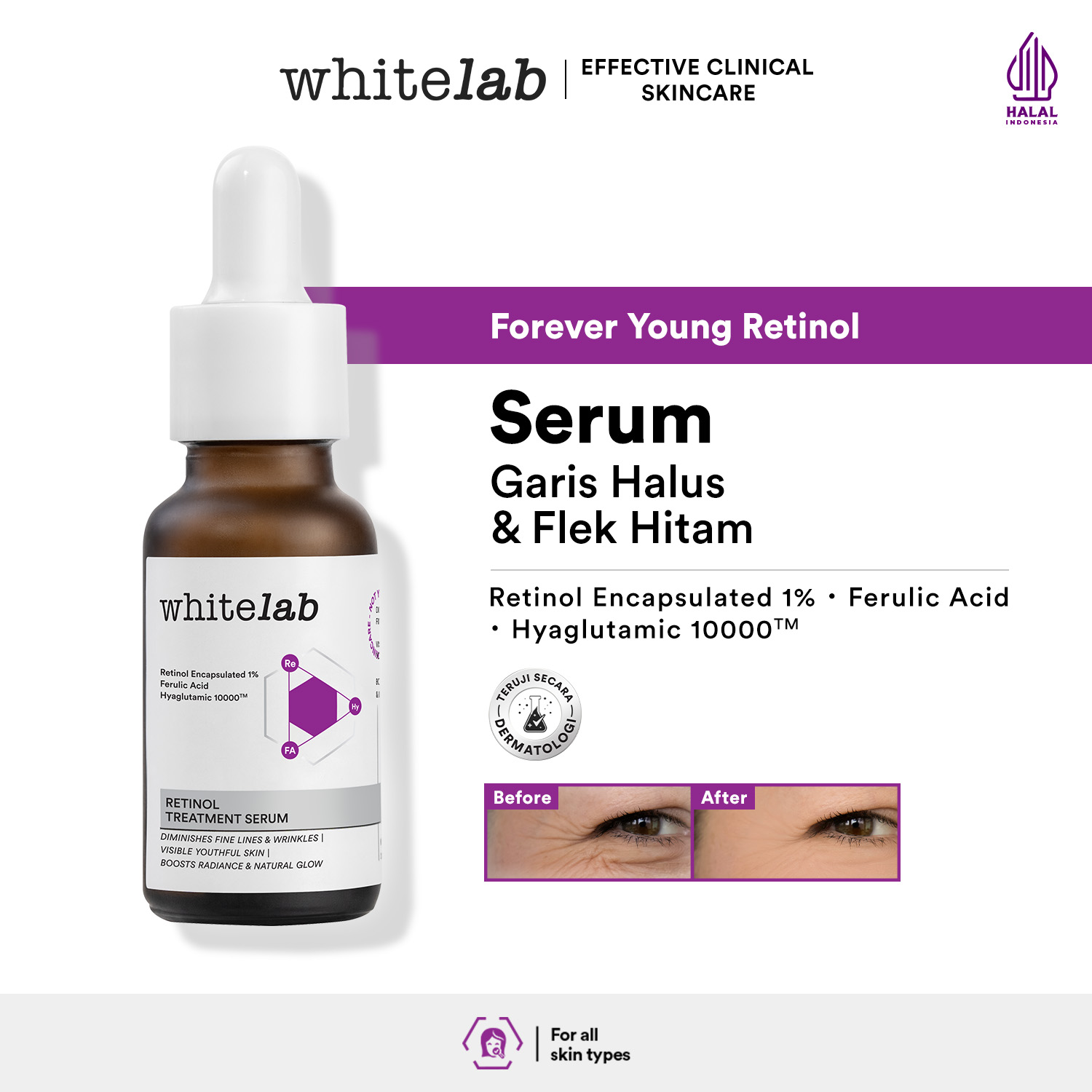 Whitelab Retinol Treatment Serum - Serum Anti Aging Kaya Antioksidan Samarkan Garis Halus Dan Flek Hitam Cocok Untuk Pemula Dengan Retinol Encapsulated 1% & Hyaglutamic [BPOM]