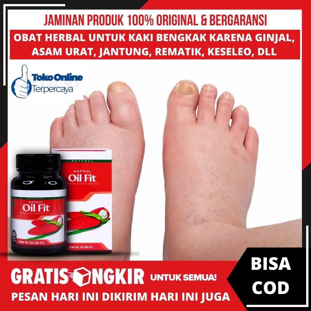 Obat Bengkak Pada Kaki [] - Obat Kaki Bengkak - Obat b1 Untuk Kaki Bengkak - Pembengkakan Kaki - Tangan Kaki Bengkak - Kaki Nyeri - Kaki Sering Bengkak - Kaki Bengkak Saat Hamil - Kaki Bengkak Karena 