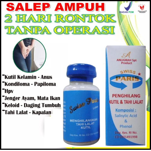 Obat Kutil Kelamin Obat Jengger Ayam Obat Kondiloma Salep Swiss Paris Lotion Original