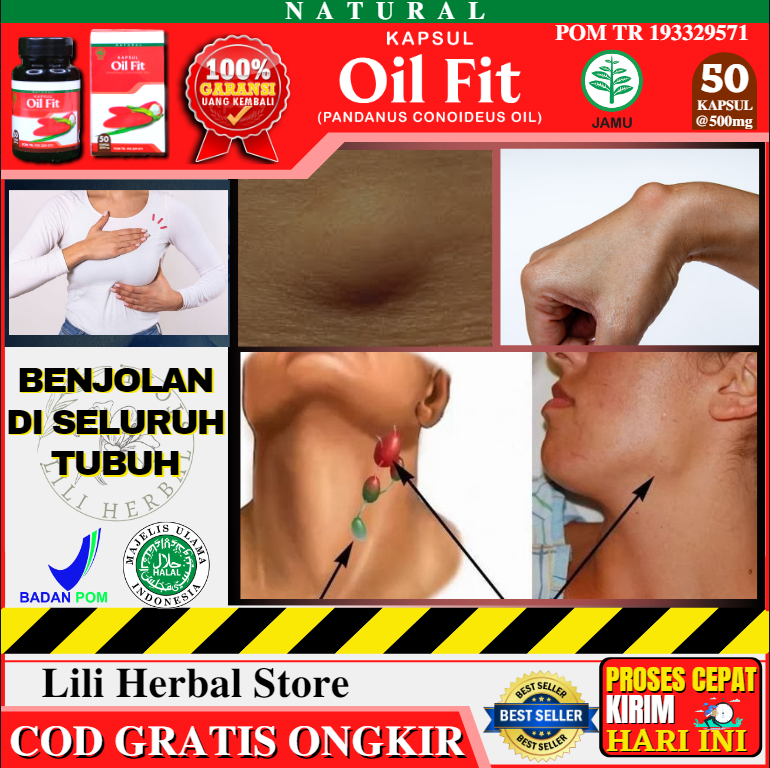 Obat Pengempis Benjolan Di Payudara Pengecil Kelenjar Getah Bening Dileher Kaki Bengkak Benjolan Di Leher Lidah Dan Punggung Uci Uci Miss V Tiroid Lipoma Ketiak Benjol Dan Nyeri Dengan OIL FIT Asli Or