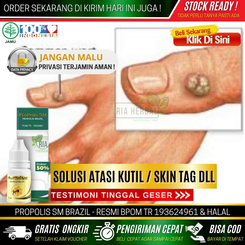 Obat Pembasmi Kutil Kelamin Membandel - Pembersih Kutilan Bandel Penghilang Kutil di Apotik Penumpas Kutil Cabut Obat Tetes Untuk Menghilangkan Kutil Virus Kutil Di Tangan Leher Wajah Kaki Kepala Gusi