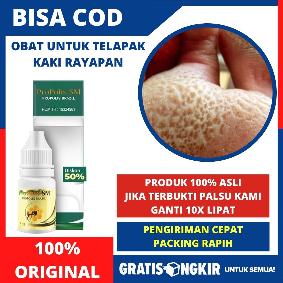 Obat Telapak Kaki Rayapan Obat Telapak Kaki Bolong Bolong Telapak Kaki Berlubang Kaki Korodok Kaki Kering Bawah Kaki Mengelupas Kaki Berkeringat Kaki Bau Menghilangkan Bau Pada Kaki Kaki Rayapan Alami