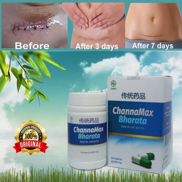 Obat pasca operasi Obat pasca melahirkan Obat pasca operasi caesar obat caesar CHANNAMAX BHARATA