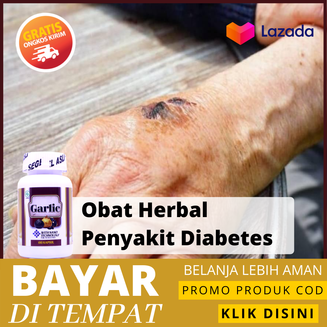 Obat Diabetes - Diabetes Insipidus - Diabetes Melitus - Obat Herbal Diabetes - Obat Diabetes Basah & Kering - Obat Penurun Gula Darah Tinggi -   Obat Penghilang Luka Diabetes dengan Black Garlic 100 %