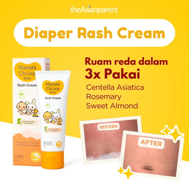 Mama's Choice Baby Diaper Cream | Rash Cream - Krim untuk meredakan biang keringat, ruam popok, ruam susu | Lazada Indonesia
