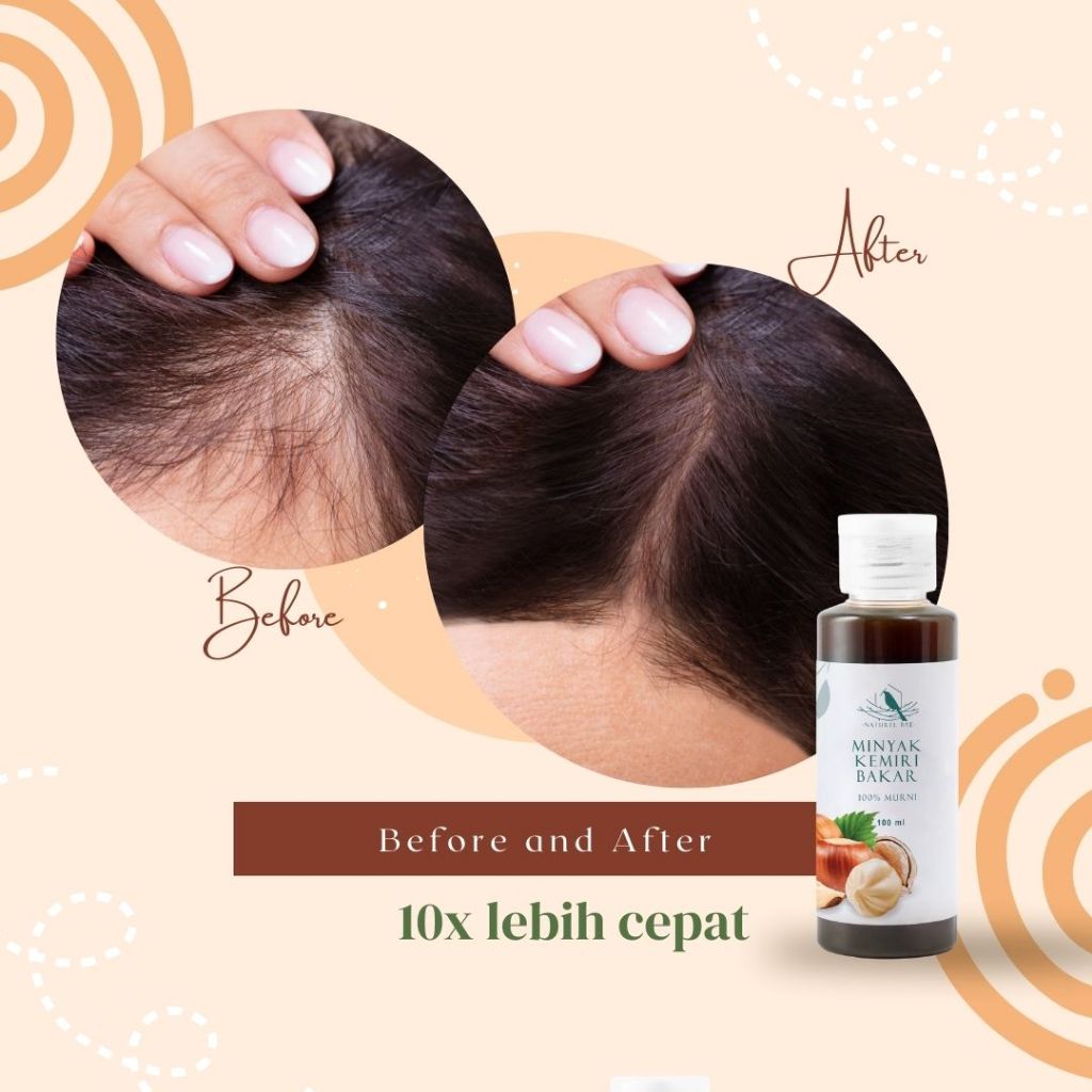 Jual Naturel Bae Minyak Kemiri Bakar Murni Penumbuh Rambut dan Alis 100ml Treatment Hair Care | Shopee Indonesia