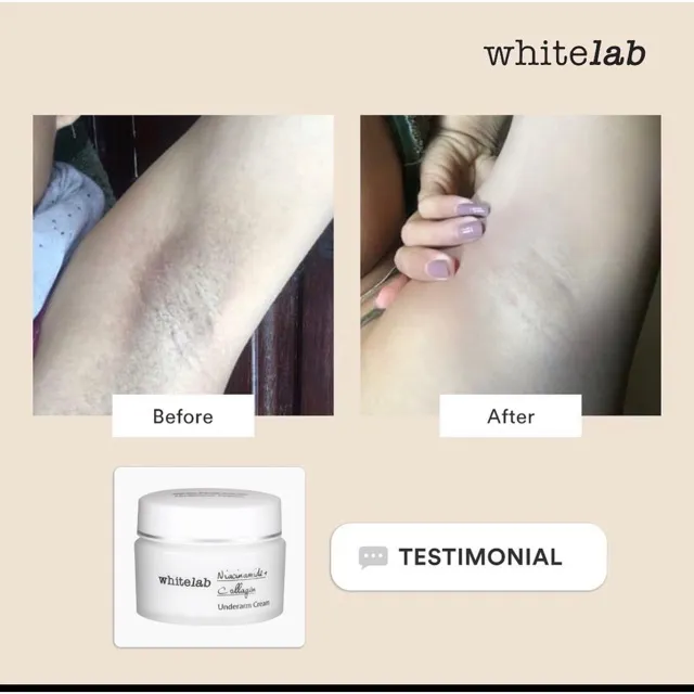 Whitelab Underarm Cream