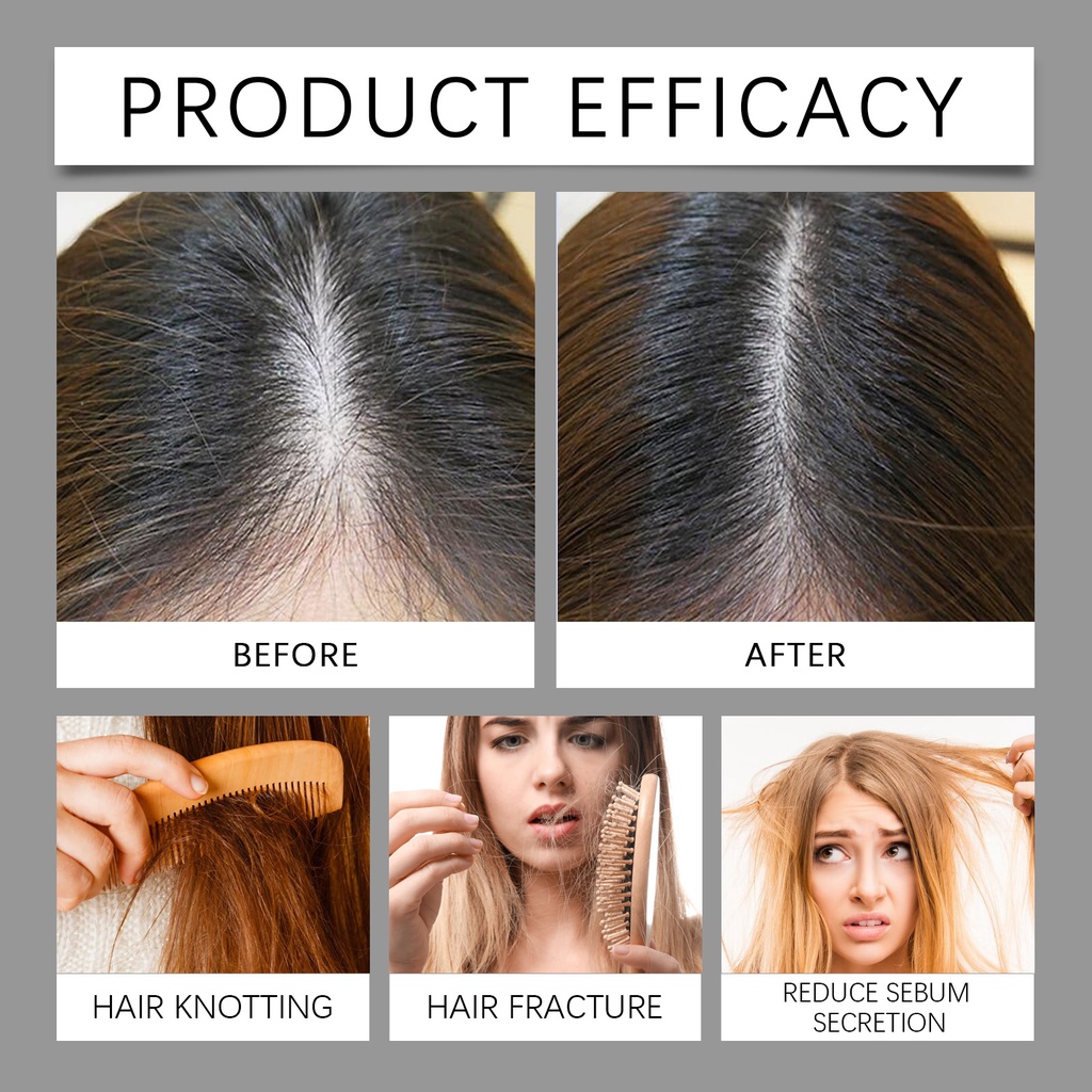 NEW GINGER HAIR CARE ESSENCE OIL ROLLER DEEP NOURISHMENT ANTI LOSE HAIR REPAIR CARE SCALP MASSAGE