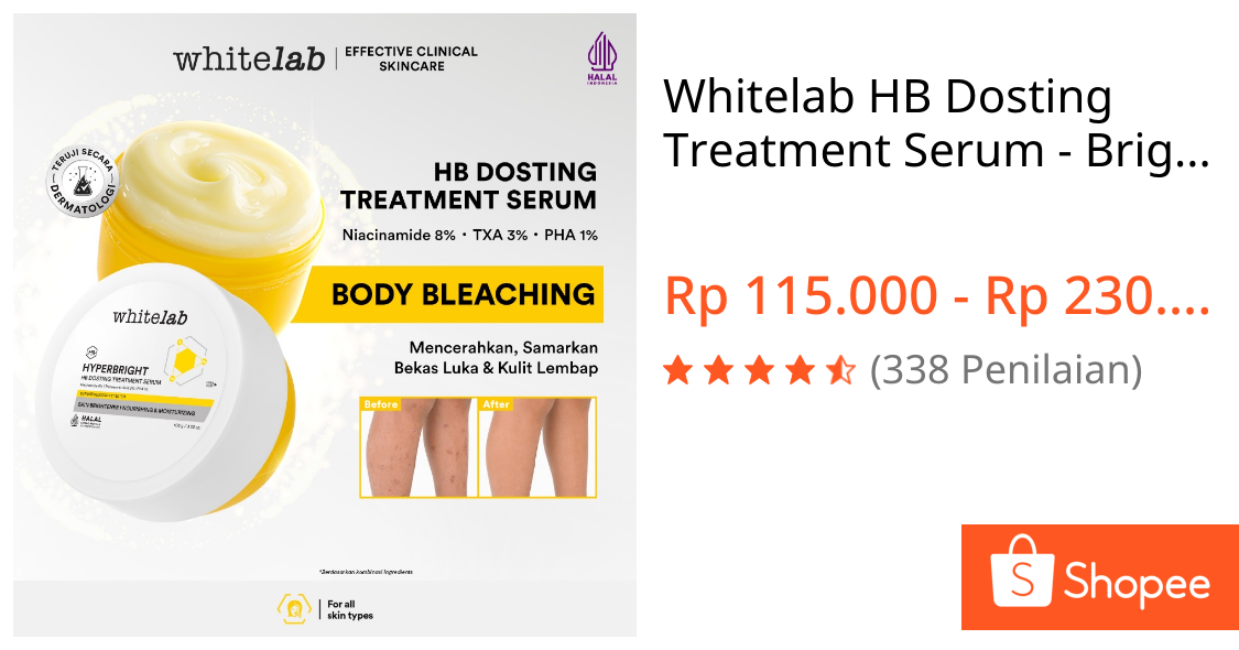 Jual Whitelab HB Dosting Treatment Serum - Brightening Body Serum dengan Niacinamide untuk Kulit Belang, Bekas Luka, Bekas Koreng & Kulit Kering | Shopee Indonesia