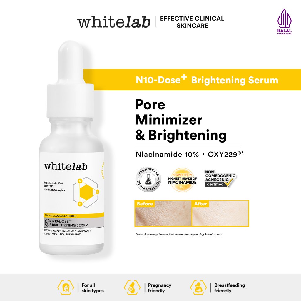[SPECIAL AFFILIATE] Whitelab Serum Niacinamide 10% Brightening - Serum Pencerah Wajah Intensif N10-Dose+ 2.0