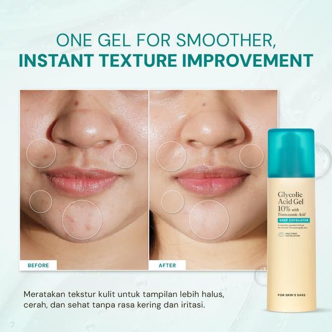 For Skin's Sake FSS Glycolic Acid Gel 10% with Tranexamic Acid Exfoliating and Multiway Toner AHA Serum AHA Masker AHA 3in1 AHA Treatment Peeling Serum Gel Mengurangi Garis Halus dan Kerutan Exfoliating and Brightening Overnight